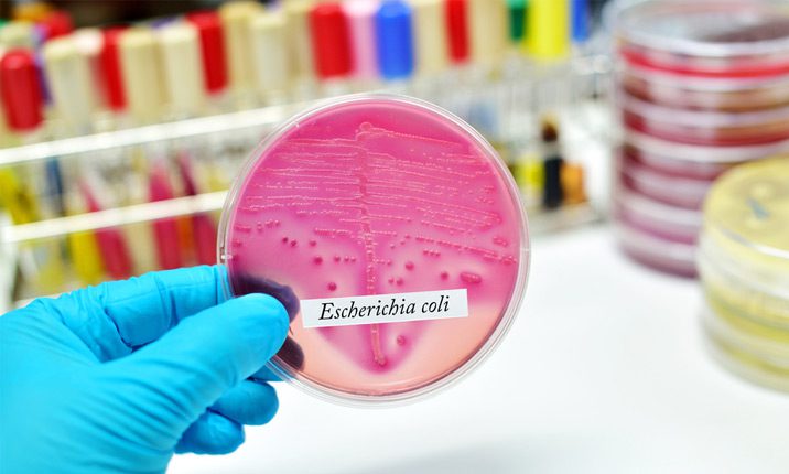 Escherichia coli (E. coli) prenatal infections