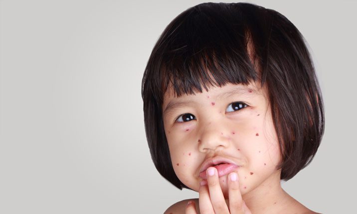 Vaccinations use the smallest dose of the virus required to generate a protective immune response