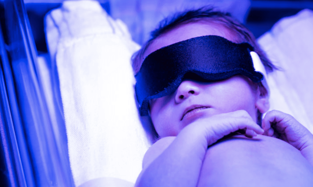 blindfolded baby, jaundice