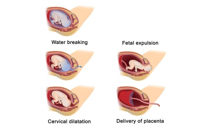 vaginal delivery childbirth for first time mothers