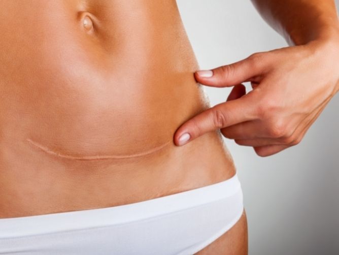 Why Caesarean Section by Dr. Christopher Chong