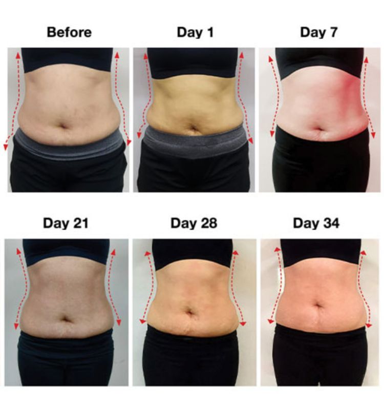 london weight management