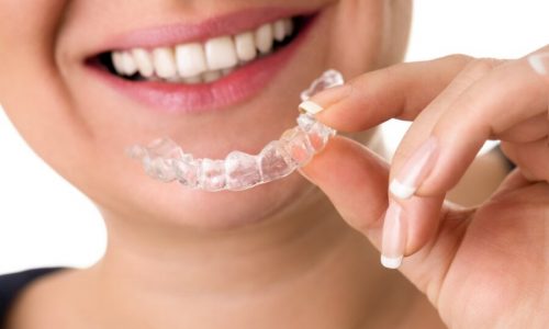 Boost Confidence with Teeth Straightening - KIYOCLEAR Aligners