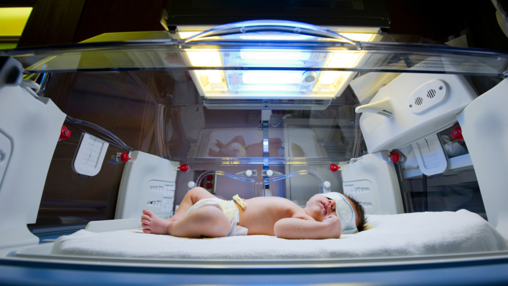 bayi prematur hidung bayi tersumbat tapi tidak pilek