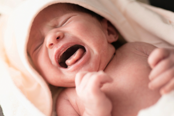 Pencegahan Iritasi Kulit Bayi
