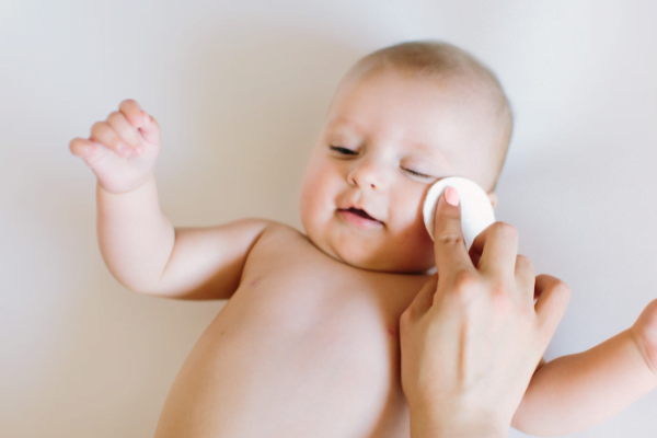 cara mengatasi iritasi kulit bayi