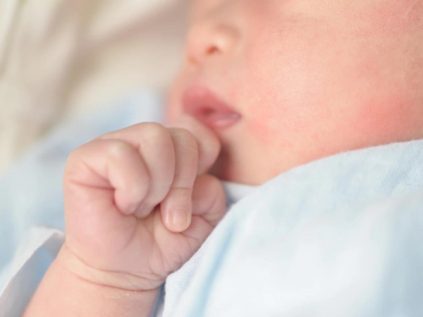 Cacar Air pada Bayi, Cari Tahu Penyebab, Gejala, dan Cara Mengatasinya