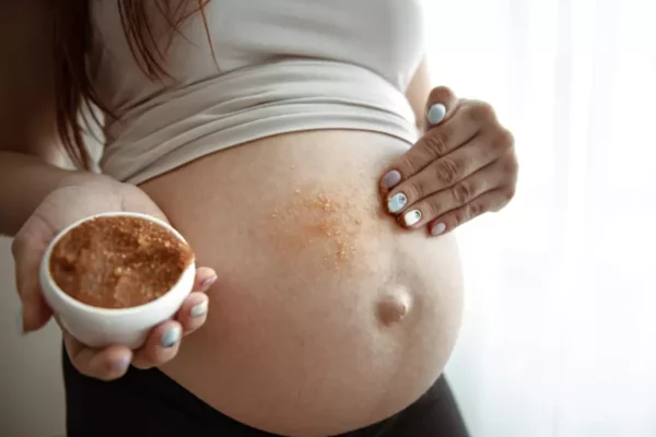 Terbentuknya Stretch Mark dan Bagaimana Lotion untuk Ibu Hamil Bisa Menguranginya