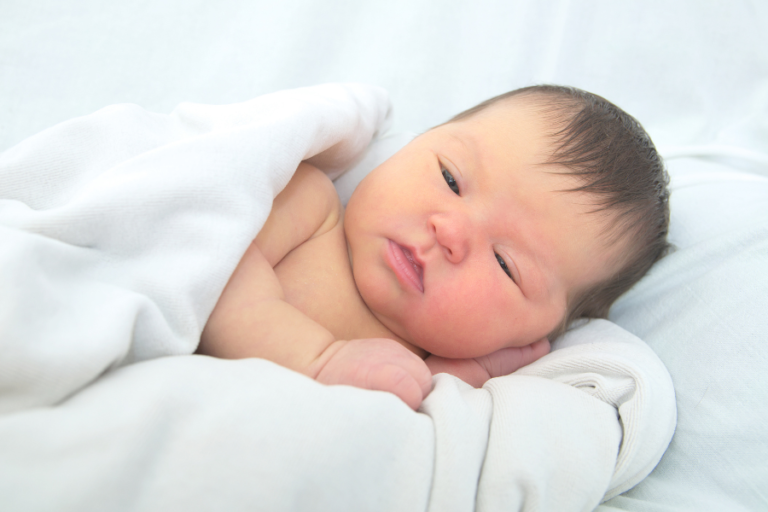Gejala, Penyebab, dan Cara Mengobati Kuning Pada Bayi Baru Lahir