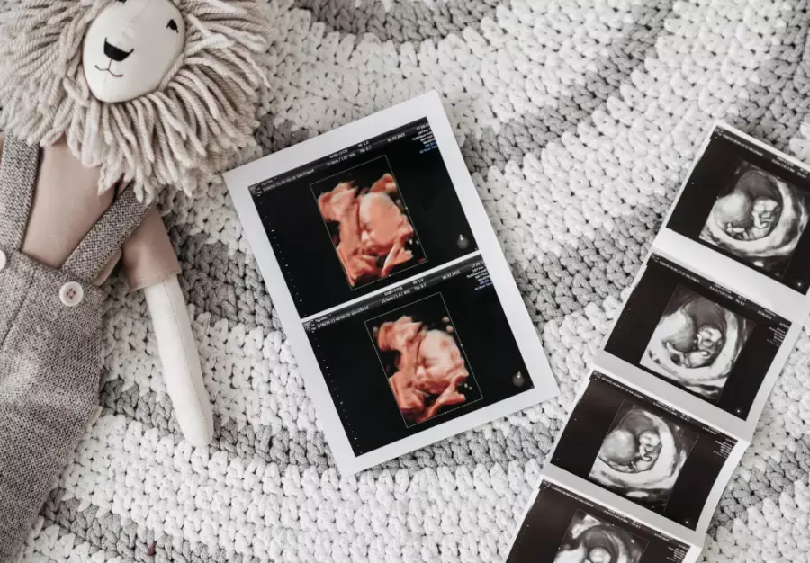 3 Cara Menghitung Usia Kehamilan, Bisa Dilakukan di Rumah Moms!