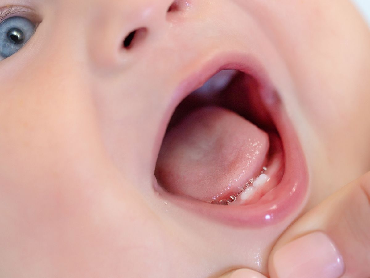 trẻ mấy tháng mọc răng