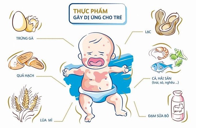 Xử Lý Tình Trạng Trẻ Em Bị Dị Ứng Thực Phẩm: Giải Pháp An Toàn Cho Bé Yêu